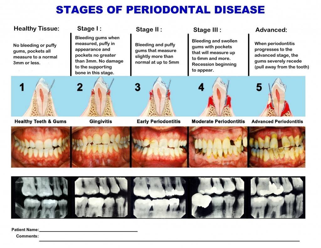 poster presentation topics in periodontics