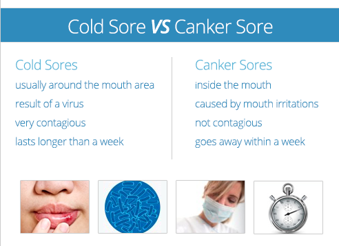 canker sore vs cold sore inside lip